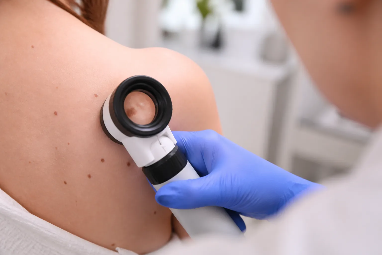 Digitalni dermatoskop za pregled madeža u dermatološkoj ordinaciji